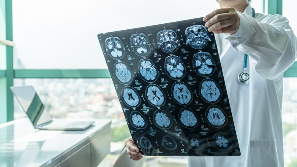5 Important Reasons to Hire a Brain and Head Injury Lawyer