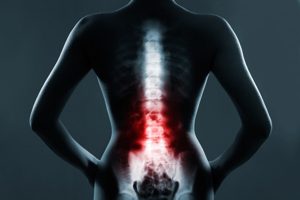 back injury lawyer Brooklyn, NY